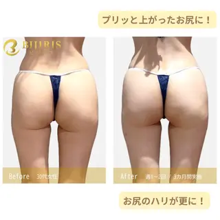 セルフ脱毛/美尻イス キングスサロン熊本のエステ・リラクイメージ