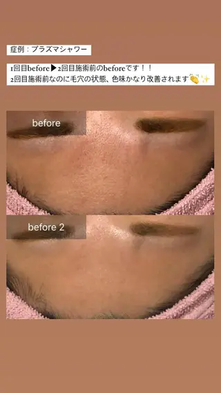 ALIA Scintiller  アリアサンティエ所属・齋藤 祐里耶のエステ・リラクイメージ