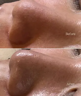 メンズ 肌／眉毛管理サロン BELL マイのその他イメージ