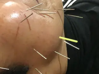 水島 秀輝（美容鍼灸師）のその他イメージ