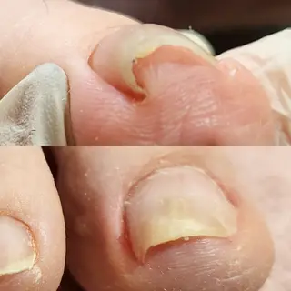 ネイル Micky nail chikushinoのネイルデザイン