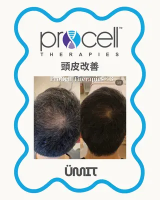 メンズ Ümit（ユミト） プロセルセラピーズのネイルデザイン