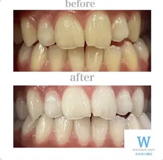 メンズ ホワイトニング ショップ本八幡店のエステ・リラクイメージ