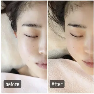 小顔美容鍼灸Acubelle Yakuin.【アキュベル薬院】所属・石川 真梨奈  美容鍼灸/アロマのエステ・リラクイメージ