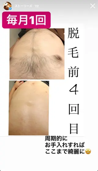 都度払い脱毛⭐️ 脱毛サロンMIRACのエステ・リラクイメージ