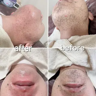 メンズ 濱田 美菜子のエステ・リラクイメージ