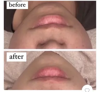 Moana【モアナ】 HIROのエステ・リラクイメージ