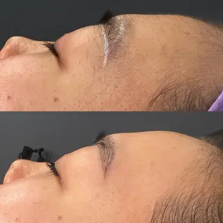 curious所属・curious kurumiのマツエク・マツパデザイン