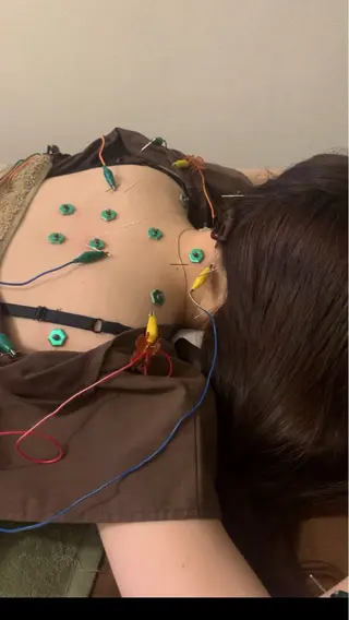 表参道鍼灸院K 美容鍼🔮ララピールのエステ・リラクイメージ