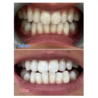 M渋谷店所属・Ｍ渋谷 ホワイトニングのエステ・リラクイメージ