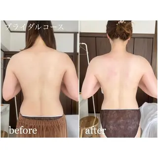 I'm -ｲﾑ-所属・肌質改善／ブライダル I'm.-イム-のエステ・リラクイメージ