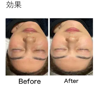 EL.ALLY イーエル.アリーのエステ・リラクイメージ