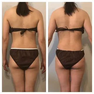 小顔・痩身専門店 Sunao所属・小顔.足痩せ整体 痩身天六Sunaoのその他イメージ