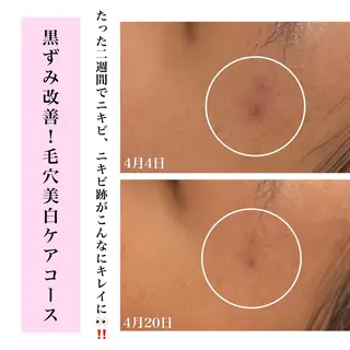 Bellesthe （ベルエステ）のエステ・リラクイメージ