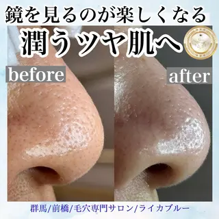 毛穴専門サロン ライカブルーのエステ・リラクイメージ