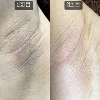 メンズ 脱毛SALON RaYNiCKのエステ・リラクイメージ