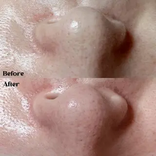 Hit. シュガーリング豊橋のエステ・リラクイメージ