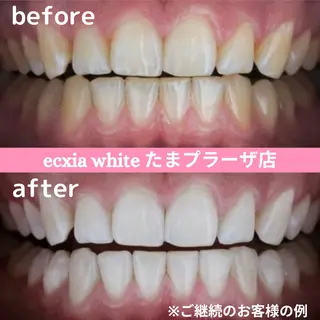 セルフホワイトニング エクシアたまプラーザ店所属・セルフホワイトニング エクシアたまプラーザのその他イメージ