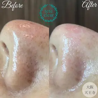 ショート 【しみ毛穴専門店】beautysalon Ankh所属・しみ毛穴専門店 Ankh 平田のエステ・リラクイメージ