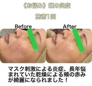 小顔&美肌品川店 Masqueradeのエステ・リラクイメージ