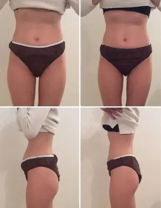 腸もみ整体プライベートサロン桜の間-乃木坂店-所属・美腸セラピストのいる 腸とカラダ専門サロンのエステ・リラクイメージ