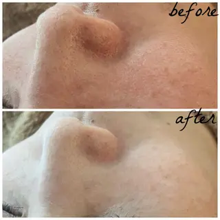 メンズ メナード岐阜市茜部 杉浦のエステ・リラクイメージ