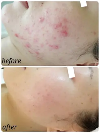 リンパケアサロン 🧡Relairのエステ・リラクイメージ