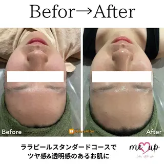 Meupニキビ専門店 背中/ハーブ/肌管理のその他イメージ