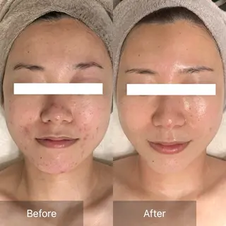 Charis エステ&ネイルのエステ・リラクイメージ