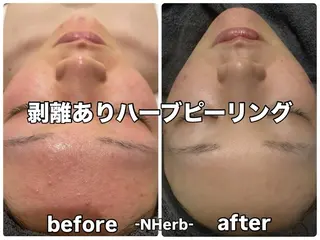 NHerb【エヌハーブ】所属・横田 汐里のネイルデザイン