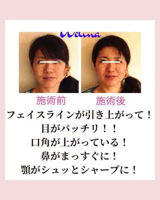 痩身・小顔・骨盤矯正×ヒップアップ専門エステ Peach所属・桃尻つかさ🍑小顔× ノーファンデ肌作りのエステ・リラクイメージ