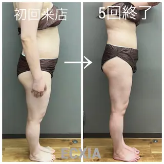 ECXIA 【エクシア】のエステ・リラクイメージ