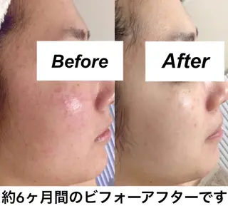 都度払い肌質改善 &脱毛Blancheのエステ・リラクイメージ