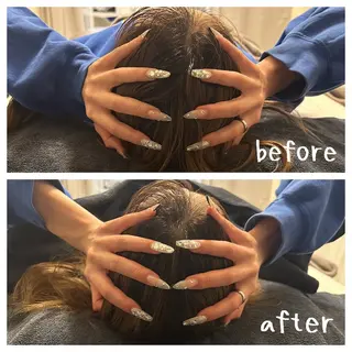 医療提携Ruby所属・医療提携Ruby小顔 ハーブピーリングのその他イメージ