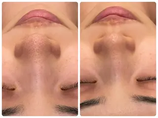 ♡RAYVIS♡ 名古屋店　神田のエステ・リラクイメージ