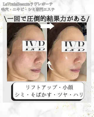 岸和田　肌改善 顧問医師提携サロンのエステ・リラクイメージ