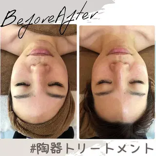 温活beautyサロンNeroli所属・切らない脂肪吸引🔥 Neroliまりこのエステ・リラクイメージ