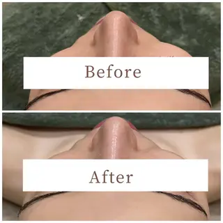 ハーブピーリング専門 muro.のエステ・リラクイメージ