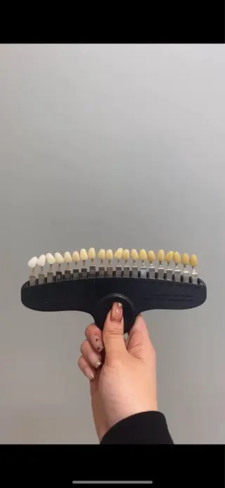 メンズ エクシアホワイトニング草津店所属・nanami -ホワイトニングのその他イメージ