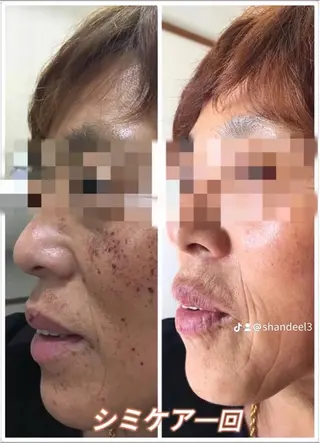 肌管理専門店 Shandeelのエステ・リラクイメージ