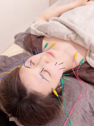 美容鍼＆鍼灸サロン 鍼Glitter.所属・鍼グリッター 仁科陽花のエステ・リラクイメージ