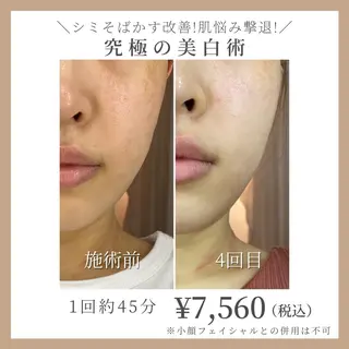 コガオファクトリー 北24条店のエステ・リラクイメージ