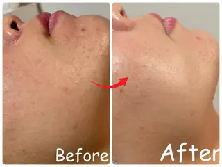 ele"ハーブ ピーリング 専門店のエステ・リラクイメージ