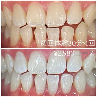 PLATINUM Beauty 横浜店所属・ホワイトニングルーム 横浜店のその他イメージ