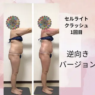 セルライトクラッシュ 腸もみ bi♡eruのエステ・リラクイメージ