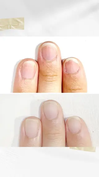 ネイル 深爪・巻き爪 専門サンセリテのネイルデザイン