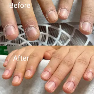 ネイル フィルイン、長さ出し 深爪矯正のネイルデザイン