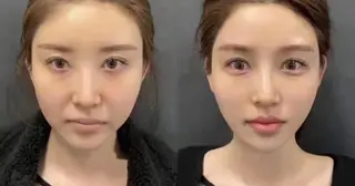 ネイル aliaハイフ&水光ジェットサロン所属・aliaハーブ水光店 エステティシャン募集のエステ・リラクイメージ