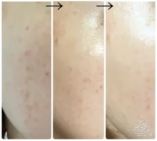 エイジングケア専門店 richbelle所属・エイジングケア専門 richbelleのエステ・リラクイメージ