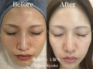 Liber Kyoto所属・魔法のシミ取り職人 CHIKAのエステ・リラクイメージ